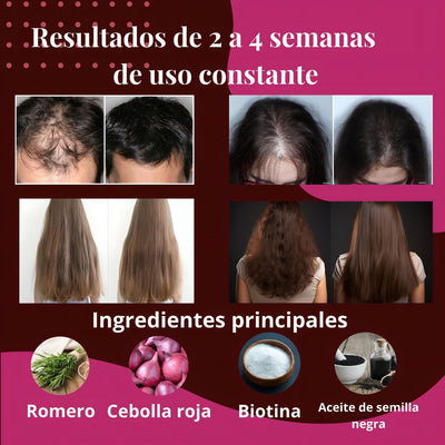 Producto para el crecimiento del cabello en kit