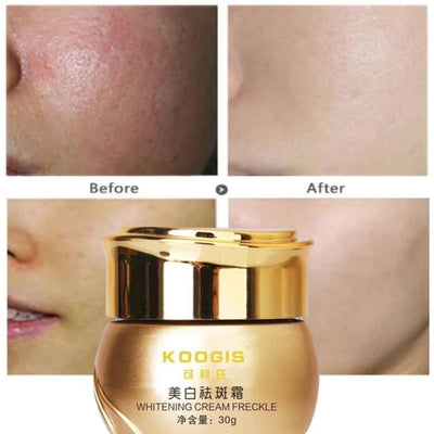 Koogis Freckle cream whitening skin care Reviews