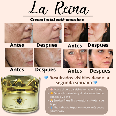 eliminar melasma y paño