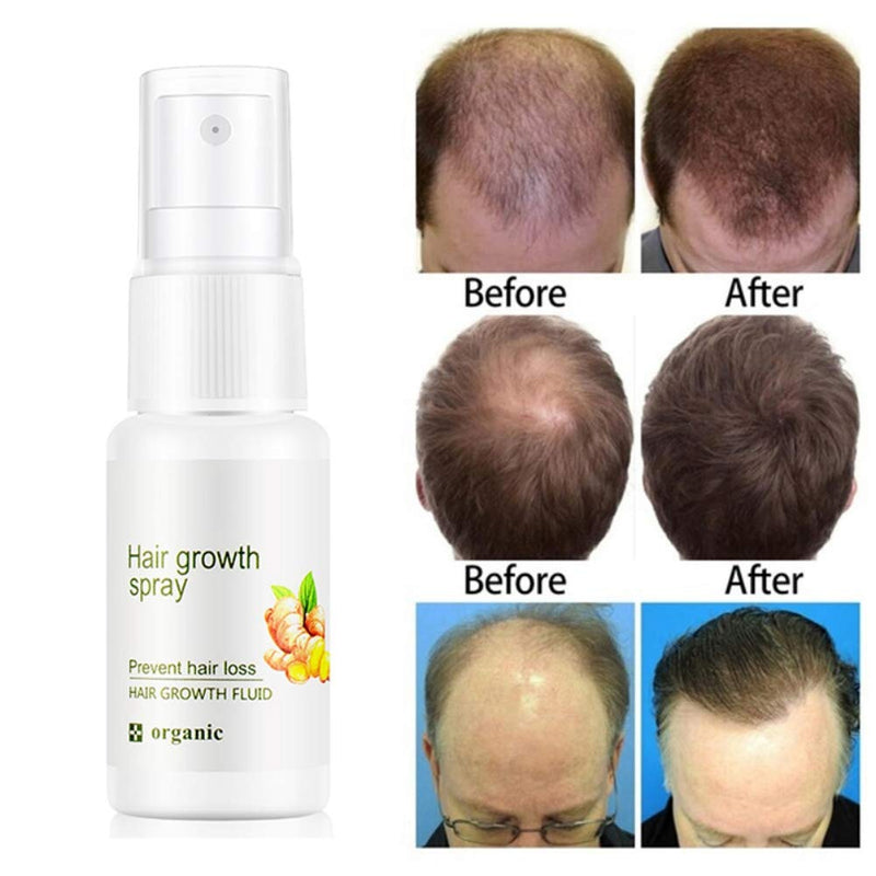  Spray orgánico para crecimiento del cabello
