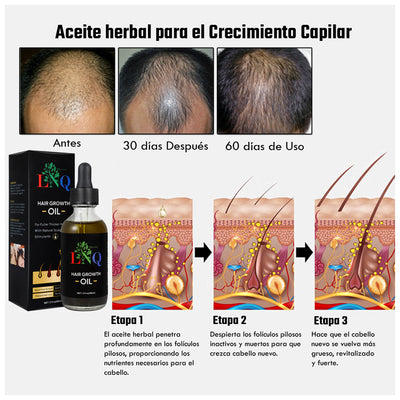 aceite capilar para detener la pérdida del cabello