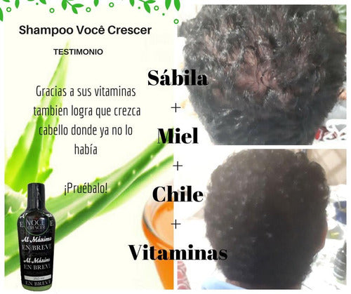 shampoo natural anticaida voce crescer
