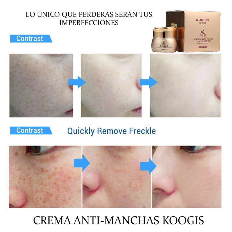 crema facial anti iperpigmentación koogis