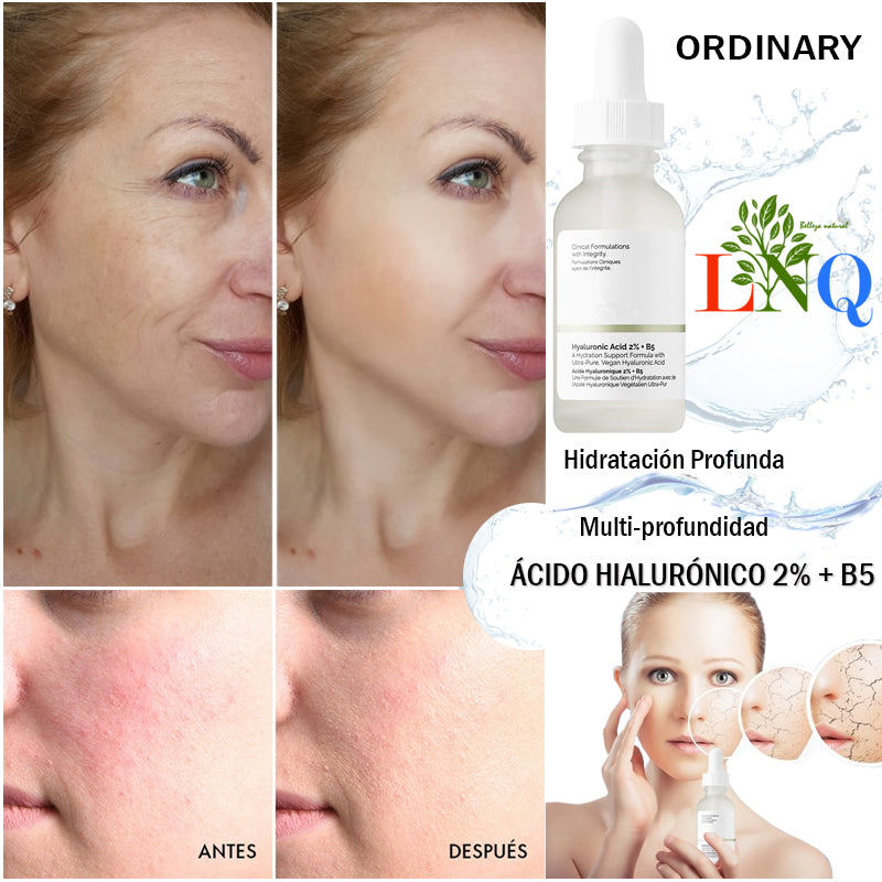 Sérum de Hidratación Avanzada de The Ordinary – La NiQuereña