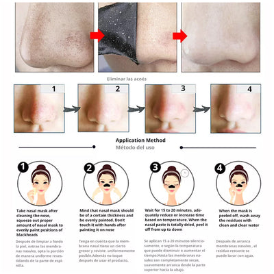 Activated Blackhead Removal