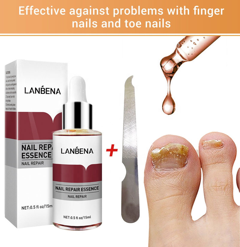 nail treatment anti fungal nail solution lanbena